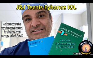 1182: the J&J Tecnis Eyhance IOL