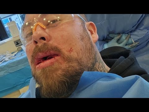 Post-surgery truth: What I discovered