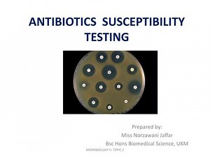 ANTIBIOTICS SUSCEPTIBILITY TESTING - SlideServe