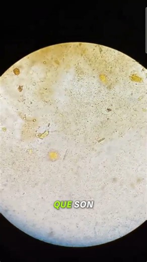 Identifiquen el parásito, reto para Biólogos y colegas del laboratorio 🧬🔬🧫🥼