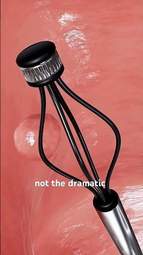 Colonoscopy Procedure! ! (3D Animation) #colonoscopy #colonoscopyprep #colonoscopyday