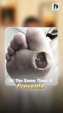 Advanced care for diabetic foot ulcers with NPWT!