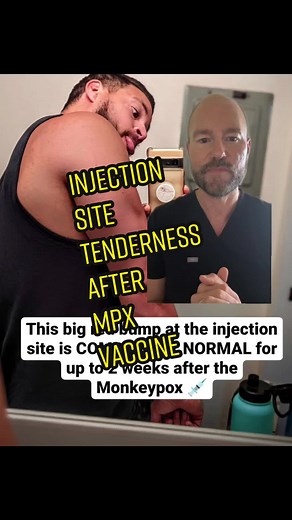 Managing Injection Site Reactions After Monkeypox Vaccine