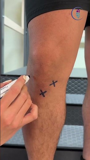 Knee injury? Identify what your injury might be. #kneepain