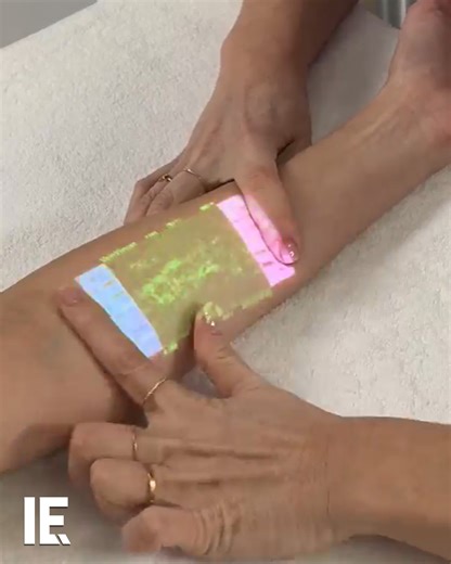 89K views · 647 reactions | Vein scanning technology is a relatively new innovation in medicine. It non-invasively shows a patient's veins and bloodflow. That allows doctors to spot any problems in advance, and speed up treatment. : Christie Medical Holdings, Inc | Interesting Engineering | Facebook