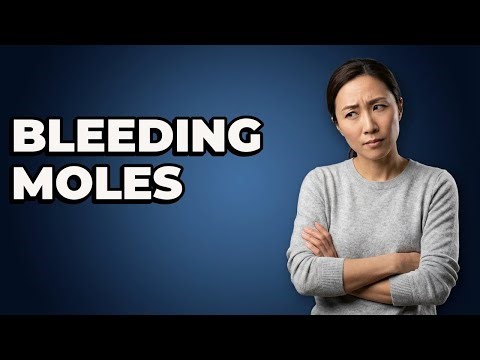 When Should I Worry About a Mole That Bleeds?