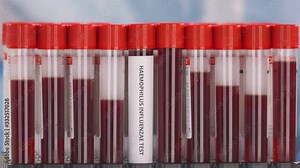 Hand wearing protection glove puts vial with haemophilus influenza test in the tube rack