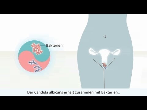 Vaginale Pilzinfektion - Was sie ist und wie sie behandelt wird?