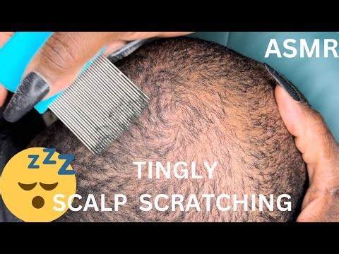 ASMR✨Tingly Scalp Scratching for Dandruff #asmr #couple #satisfying