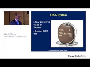 Acute and chronic performance of communicating leadless anti-tachycardia pacemaker and S-ICD