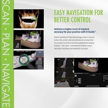 X Guide Video Brochure