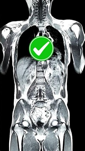 X-Ray vs CT-scan vs MRI