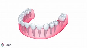 1M views · 2.3K reactions | #Dental Implants in  #Turkey. Our Dental & Oral Surgeons are experts in all types of Dental Surgeries. Call now for your free consultation. #WebSite https://internationalplus.net #WhatsApp: wa.me/905359632630 | International Plus Dental | Facebook