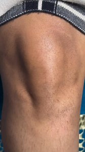 76K views · 60 reactions | How To Get Rid Of Sun Tan/Sun Tan Removal At Home . . . #suntan #tanning #darkness #dirtremoval #fairfeetinstantly #trendingreels #fbreelsfypシ゚ #reelsviralシfb #viralreelschallenge #reelsfypシ #everyonefollowers | Natural Beauty Remedy | Facebook