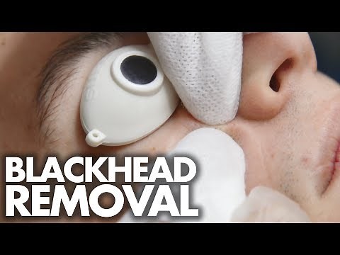 Guy Gets His First FACIAL w/ Blackhead Extractions (Beauty Trippin)