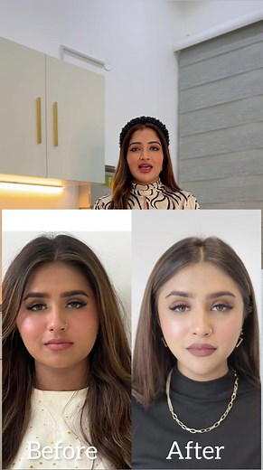 Barbie Face Transformation by Dr. Jia in Abu Dhabi