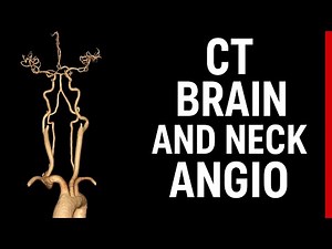 CT Neck And Brain Angiography / CECT Brain And Neck Angio Procedure