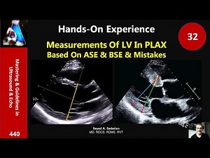 Measurements Of LV In PLAX Based On ASE & BSE & Mistakes: Hands-on 32