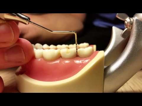 How To Use The Periodontal Probe