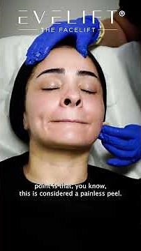 VI Peel Precision + Peptides For Skin Rejuvenation | Eden Plastic Surgery
