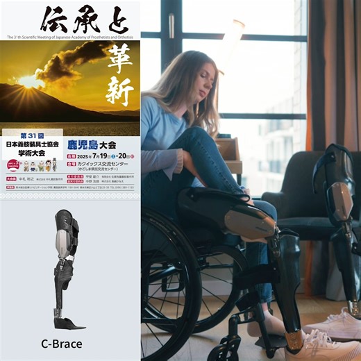 日本義肢装具士協会学術大会 展示情報 in 鹿児島 C-Braceはマイクロプロセッサーを搭載し、下肢筋力低下による歩行困難者をサポートする長下肢装具用の膝継手です。 『歩行』を自動検知し、遊脚相で膝を曲げて歩行することが可能です。 さらに油圧シリンダーが搭載されているため、油圧抵抗を伴う座位動作、階段の交互下りも可能にします。 海外では、車いす生活をしていた脊損患者様がC-Braceによって再び歩行を獲得するケースが多数報告されています。 会期：2025/7/19(土) ～ 7/20(日) 会場：カクイックス交流センター/鹿児島 www.ottobock.com/ja-jp/japo | Ottobock