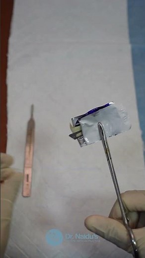 How to Attach a Scalpel Blade to a Handle