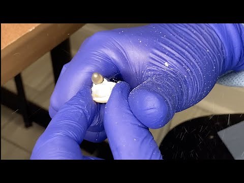 Fabricating a Single Unit Temporary Crown