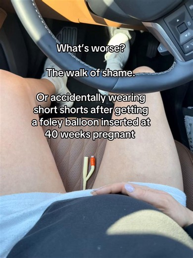 Foley balloon induction at 40 weeks: what to expect walking back to the car