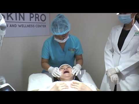 Skin Pro: Fotona 4D Facelift