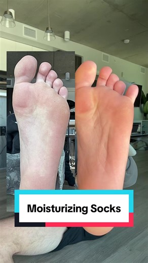 Transform Your Feet with Moisturizing Socks: A Game Changer