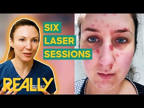 Dr. Emma Addresses a Patient's Irritating Skin Condition | The Bad Skin Clinic