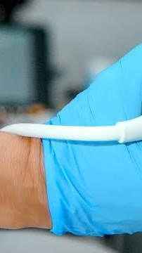 How is Doppler ultrasound performed?