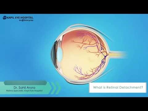 What Is Retinal Detachment? Know the Signs, Causes & Treatment | Dr. Sahil Arora – Kapil Eye Hospita
