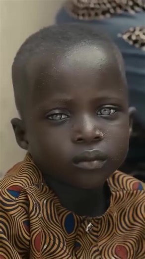 Blue eyes are rare in Africa, but they do exist 🌍👁️. Here are a few facts you can share with your audience: 🔹 Genetic Rarity – Most Africans have brown eyes because of high melanin, but blue eyes can appear due to genetic variation, albinism, or inherited European/Middle Eastern ancestry. 🔹 Ethiopia – Some Ethiopian and Eritrean people naturally have blue or green eyes, often celebrated as a unique beauty in the Horn of Africa. 🔹 North & East Africa – In regions like Morocco, Tunisia, and E