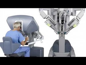 Single Site Robotic Gallbladder Surgery
