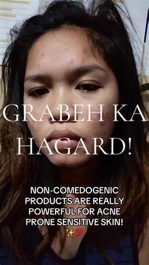 Achieve Clear Skin with Non-Comedogenic Products