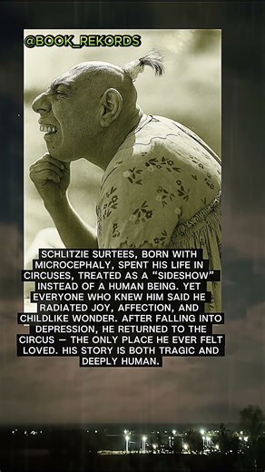 ✨ The Heartbreaking Life of Schlitzie #book_records