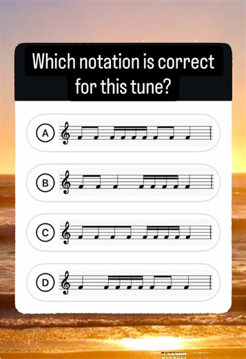 Guess the Correct Rhythmic Notation in This Quiz