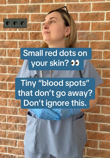 Tiny Red Dots on Skin? Don’t Ignore This Sign Small red or purple dots on the skin that don’t fade when pressed may be petechiae — tiny spots caused by bleeding under the skin. They can sometimes signal infections, platelet problems, or medication side effects. If they appear suddenly or start spreading, it’s important to get checked. #HealthWarning #Petechiae #SkinSigns #HealthEducation #KnowTheSigns