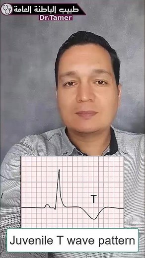 Juvenile t wave pattern #طبيب_الباطنة_العامة