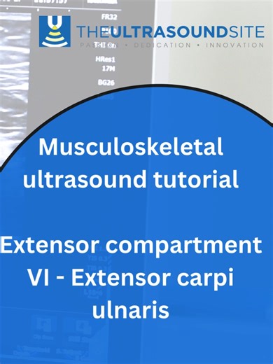 Ultrasound Tutorial: Extensor Compartment VI