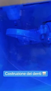 Dopo anni di battaglie con i miei problemi dentali, finalmente ho ritrovato la voglia di sorridere senza farmi problemi !! 🥺🙁😍❤️ grazie a e tutta l equipè !! ❤️🙏🦷 Vi piace il mio nuovo sorriso ?! 🥰 #suppliedby\u0016 | G00D View