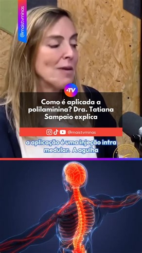 Mais TV Minas | Após mais de 25 anos de pesquisa, a cientista brasileira Tatiana Coelho de Sampaio (UFRJ) desenvolveu uma substância inovadora chamada... | Instagram