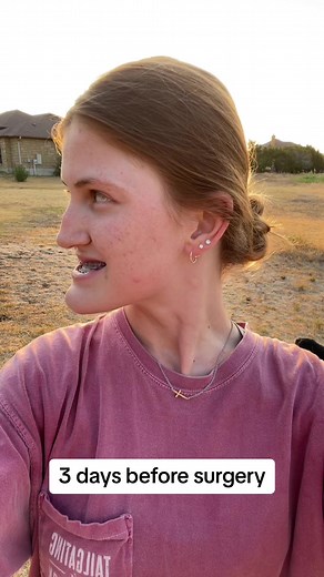 Orthognathic Surgery for Severe Underbites Explained