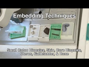 Embedding Techniques for Histotechs: How to Properly Embed Tissue
