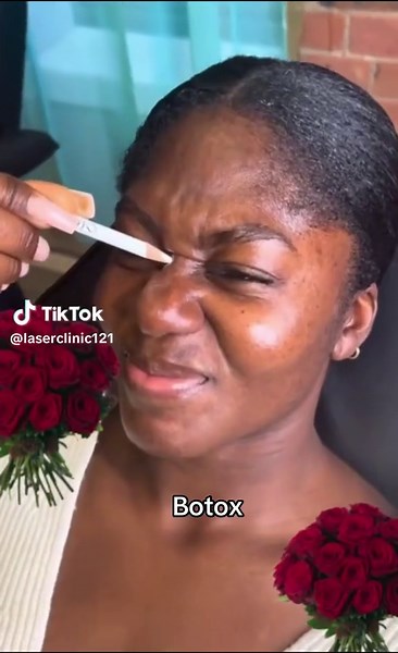 Understanding Botox: Benefits and Considerations