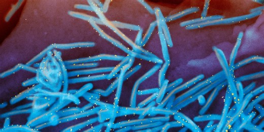 Virginia offers case-by-case RSV protections instead of an extended immunization period