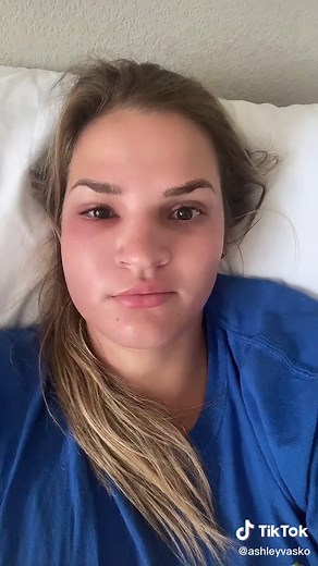 Understanding the Apicoectomy Dental Procedure