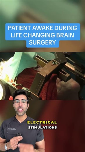 Brain Surgery, But You're Awake
