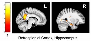 UCI SPATIAL NEUROSCIENCE